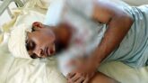 রাজাপুরে দুর্বৃত্তের হামলায় কলেজ ছাত্র জখম