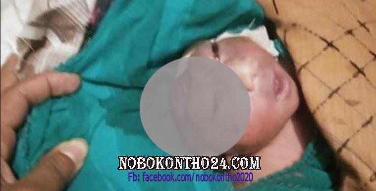 পিরোজপুরে মাথার খুলি বিহীন শিশুর জন্ম !