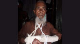 পটুয়াখালীতে ভরণপোষণ চাওয়ায় বাবার হাত ভেঙে দিল ছেলে