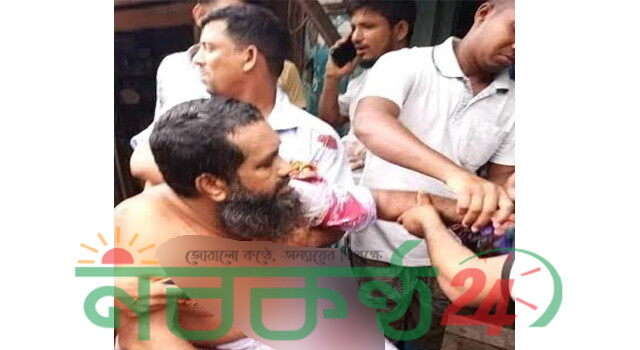 আমতলীতে আ.লীগ নেতাকে কুপিয়ে জখম