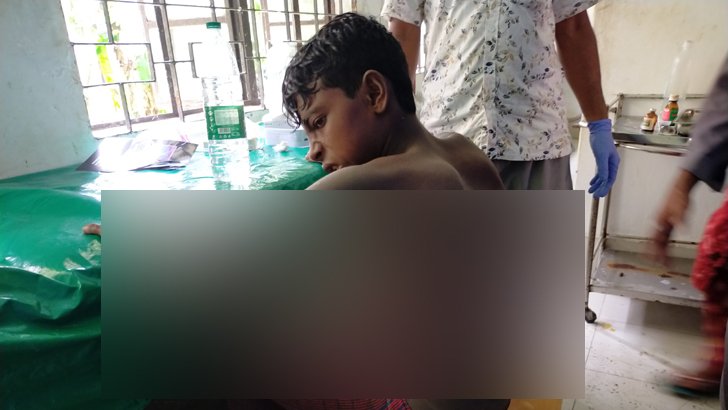 ভোলায় ট্রলারে গ্যাসের চুলার আগুনে পুড়ল জেলের শরীল