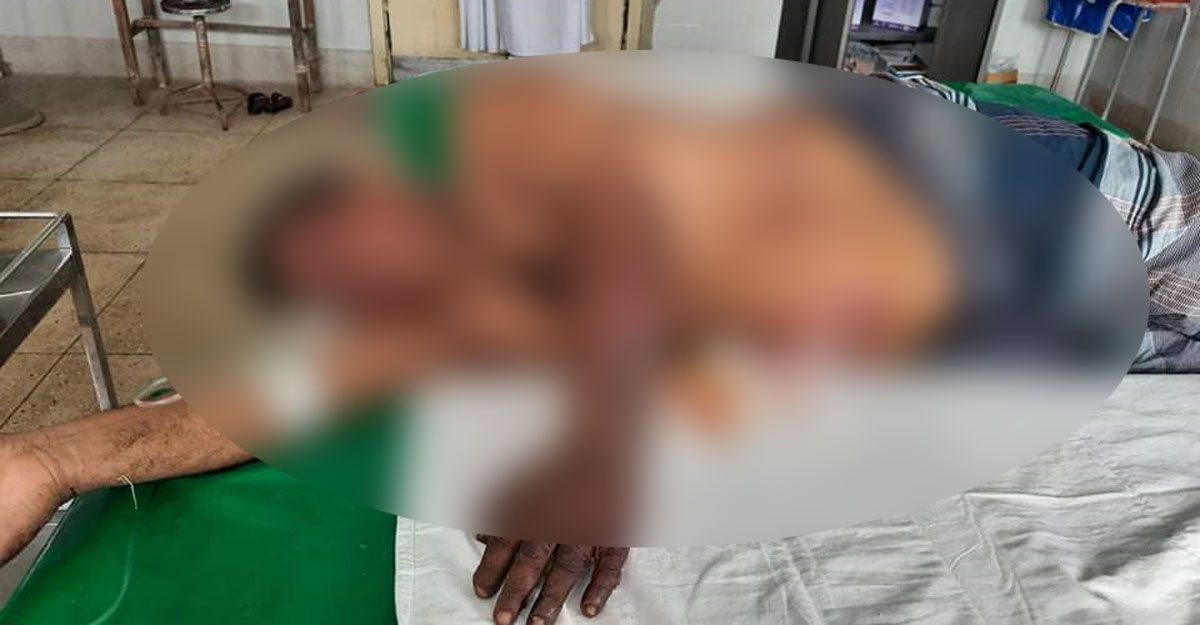 ঘরের ভেতর বোমা তৈরির সময় বিস্ফোরণ, আহত ২