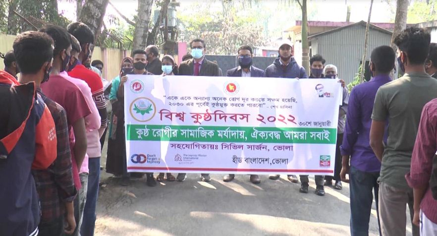 ভোলায় বিশ্ব কুষ্ঠ দিবস পালিত