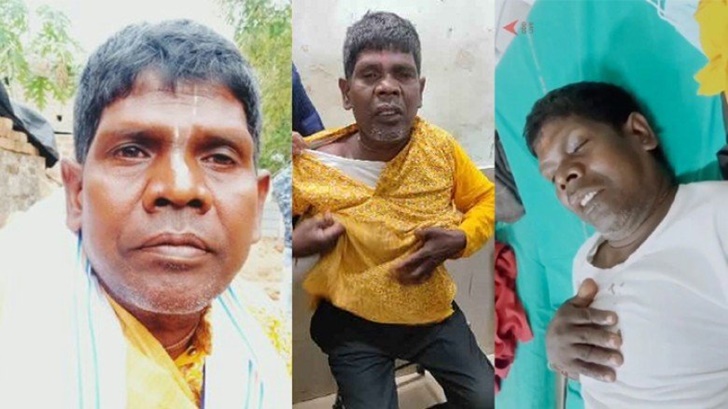 দুর্ঘটনায় আহত ‘কাঁচা বাদাম’ গায়ক ভুবন বাদ্যকর