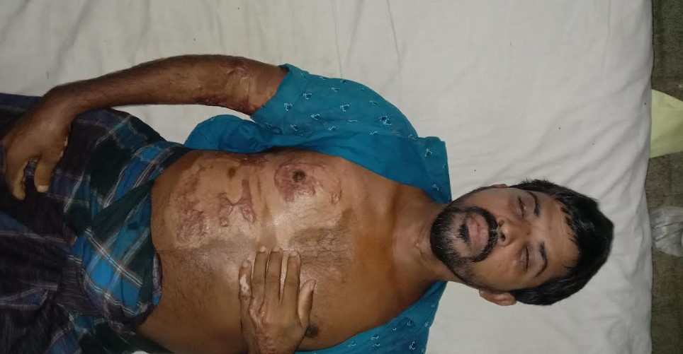 কুয়াকাটায় তুচ্ছ ঘটনাকে কেন্দ্র করে প্রতিবন্ধীকে মারধর!