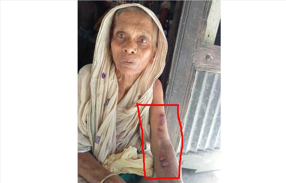 বীরমহলে সন্তানের হাতে মারধরের স্বীকার বৃদ্ধ মা