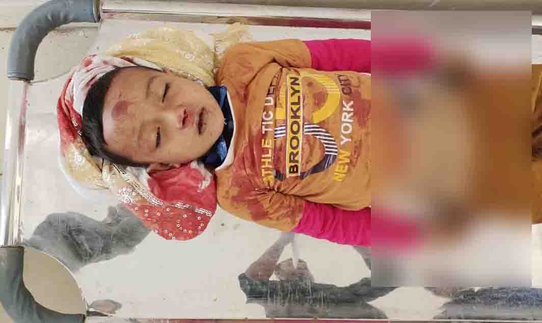 ঝালকাঠিতে সড়ক দুর্ঘটনায় শিশু শিক্ষার্থী নিহত