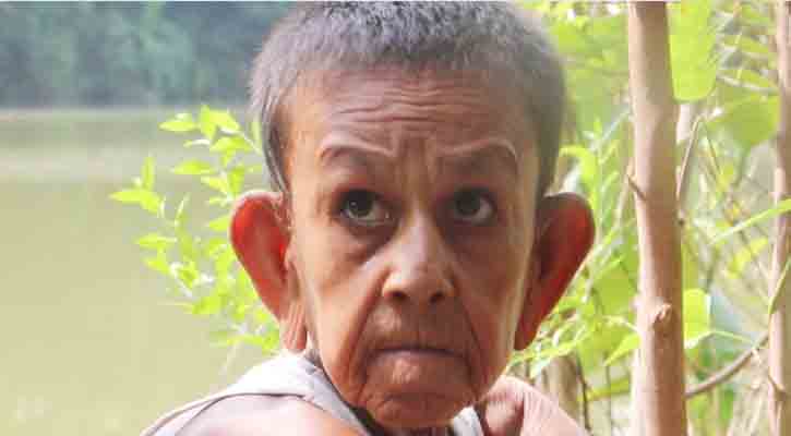 দশ বছরের শাহাদাতকে দেখতে লাগে ৮০ বছরের!